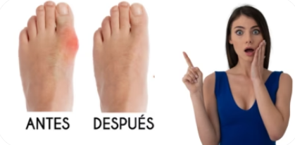 Corrector De Juanetes
