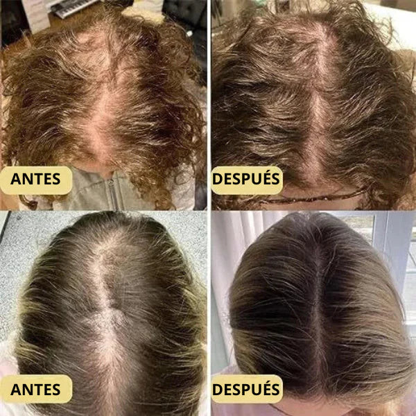 Crecimiento Del Cabello | Aceite Natural Vegano 2X1